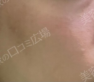 治療結果の症例写真