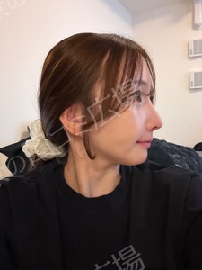 治療前の症例写真