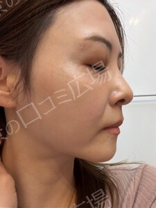 治療結果の症例写真