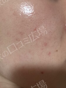 治療結果の症例写真
