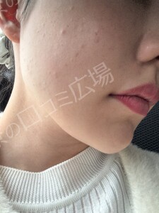 治療結果の症例写真