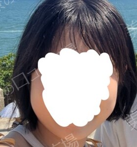 治療直後の症例写真
