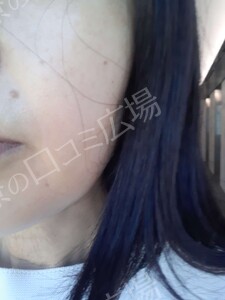 治療前の症例写真