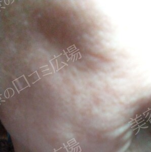 治療結果の症例写真