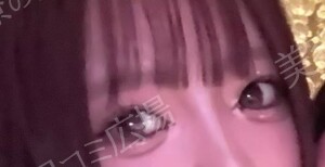 治療結果の症例写真