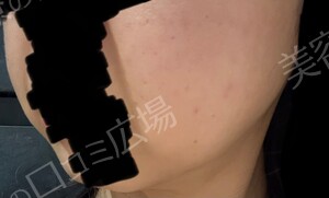 治療前の症例写真