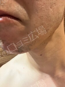 治療前の症例写真