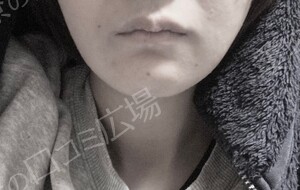 治療結果の症例写真