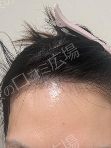 治療前の症例写真