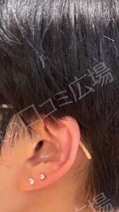 治療前の症例写真