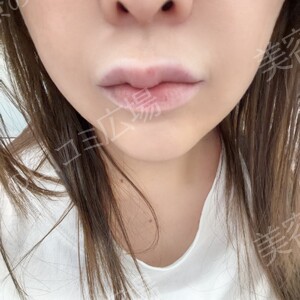 治療結果の症例写真