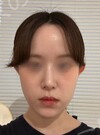 施術前の状態