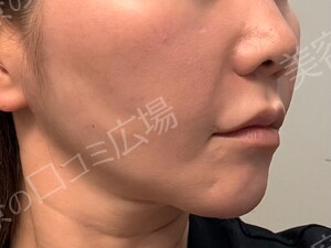 治療前の症例写真