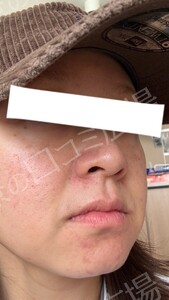 治療前の症例写真