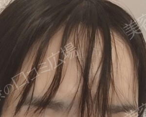 治療前の症例写真