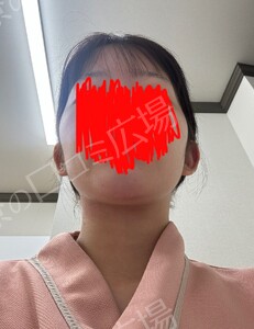 治療前の症例写真