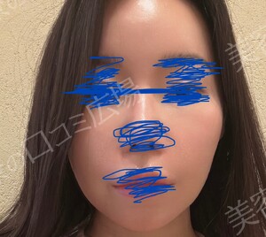 治療結果の症例写真