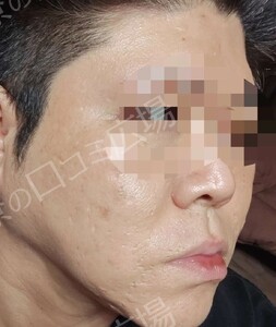 治療結果の症例写真