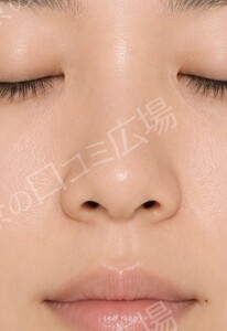 治療結果の症例写真