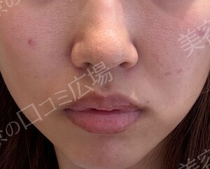 治療前の症例写真