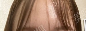 治療結果の症例写真