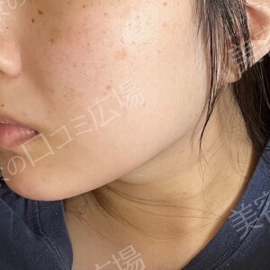 治療結果の症例写真