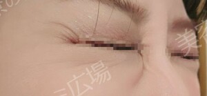 治療前の症例写真