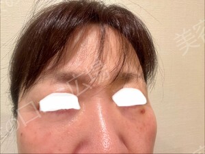 CLINIC Wの症例写真[アフター]