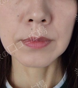 治療前の症例写真
