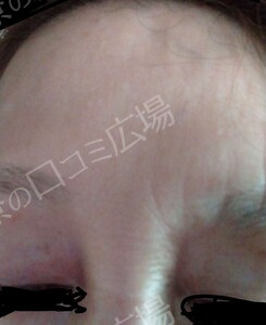 治療前の症例写真