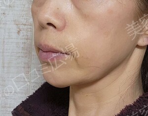 治療結果の症例写真
