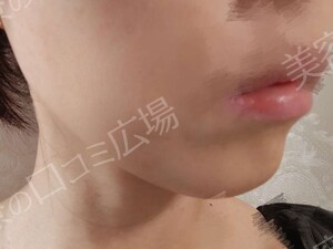 治療結果の症例写真