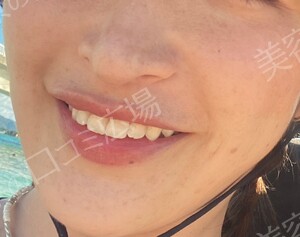 治療前の症例写真