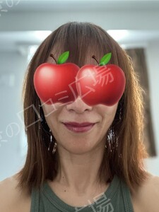 治療前の症例写真