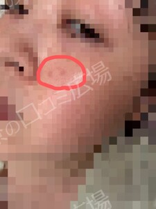 治療結果の症例写真