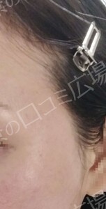 治療前の症例写真