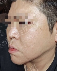 治療結果の症例写真