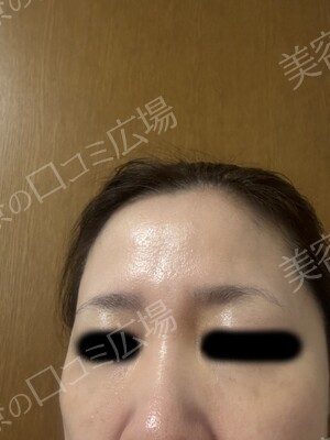 CLINIC Wの症例写真[アフター]