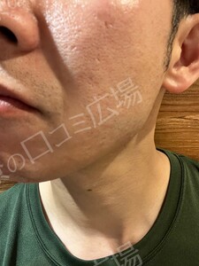 治療結果の症例写真