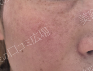 治療結果の症例写真