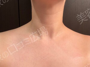 治療結果の症例写真