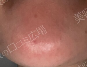治療前の症例写真