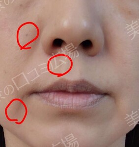 治療結果の症例写真