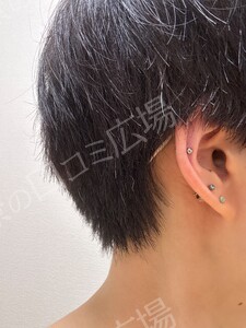 治療直後の症例写真