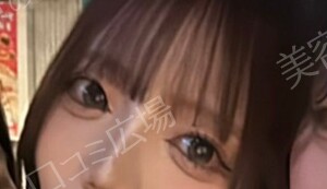 治療結果の症例写真