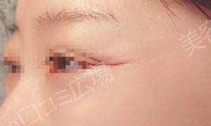 治療前の症例写真
