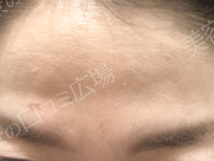 治療前の症例写真