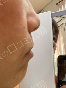 治療結果の症例写真
