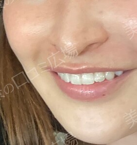 治療結果の症例写真