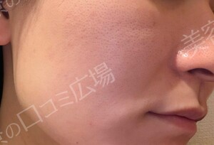 治療結果の症例写真